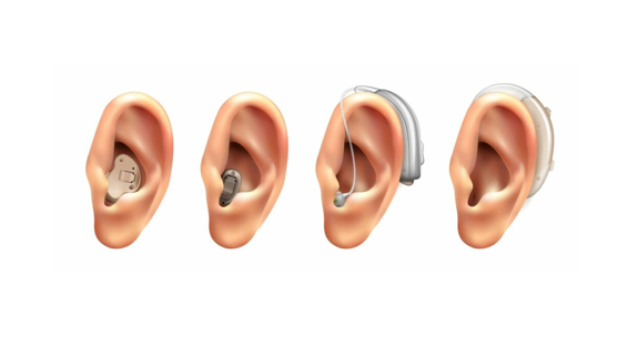 Aides auditives invisibles vs contours d’oreille
